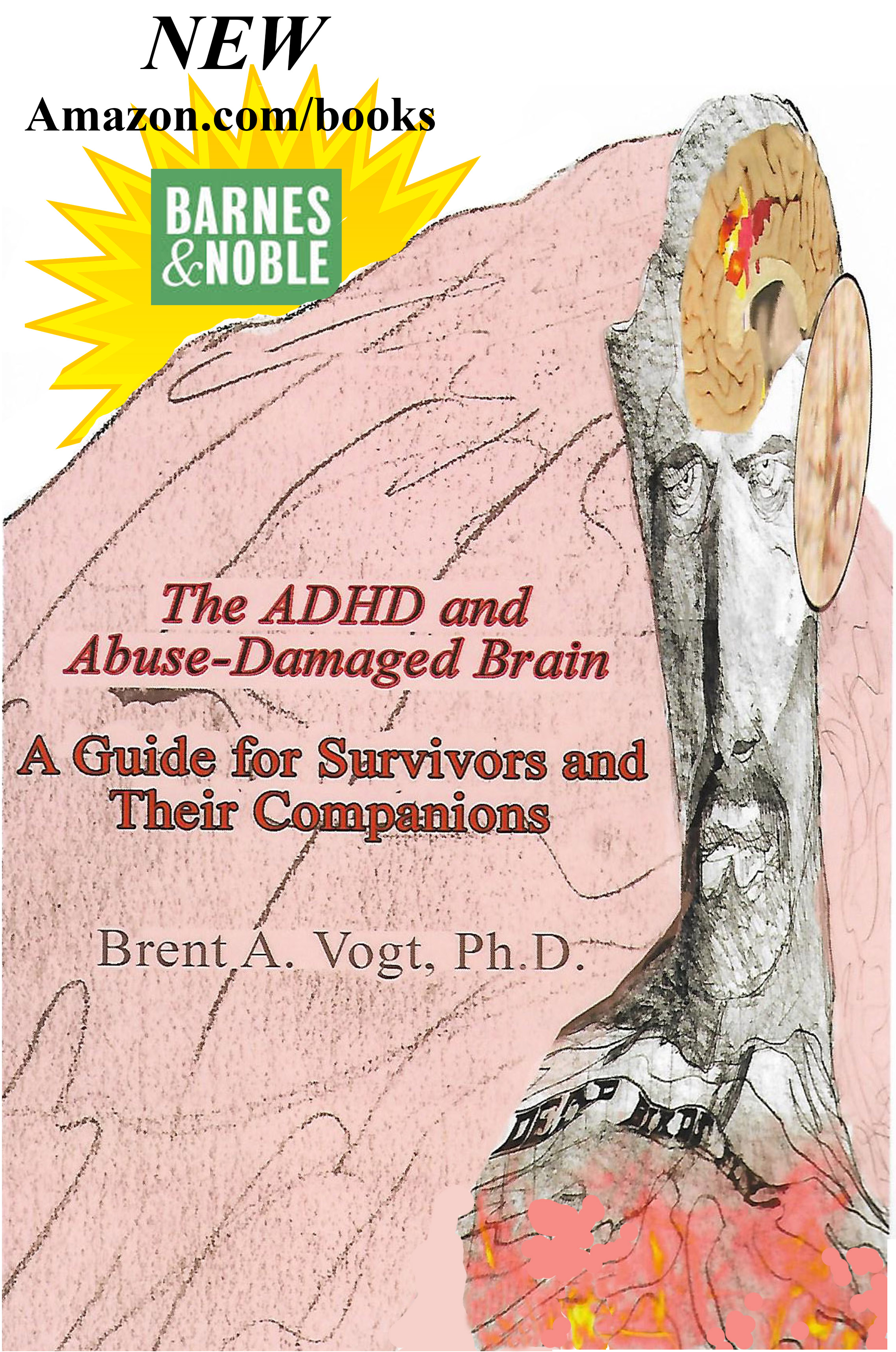 The ADHD and Abuse-Damaged Brain