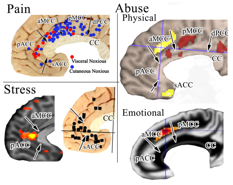 what does brain research tell us about abuse and neglect