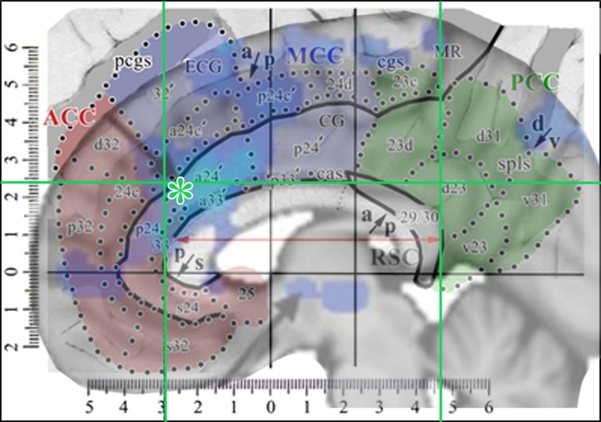 Where is Cingulate Cortex? A Cross-Species View: Trends in