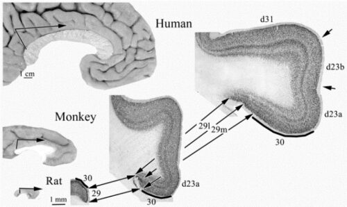 human-cingulate-cortex-img6