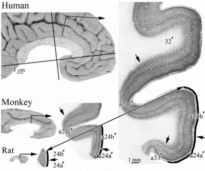 human-cingulate-cortex-img8